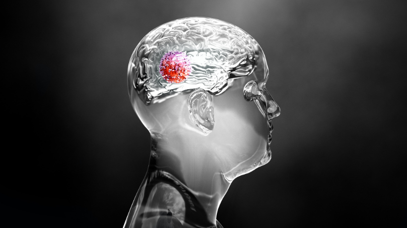 A transparent, 3D illustration of a child-sized human head (side-profile) depicts a brain with a mass growing in the rear-right quadrant - the mass has been highlighted bright red to make it stand out; the background is black to increase the contrast.